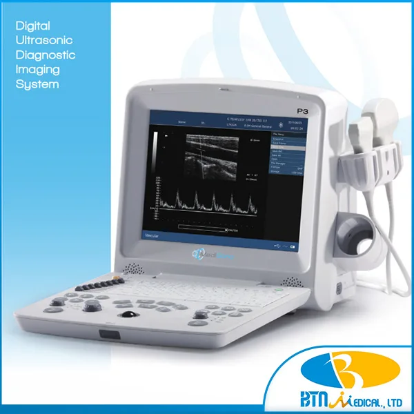 Máy siêu âm xách tay ký thuật số P3